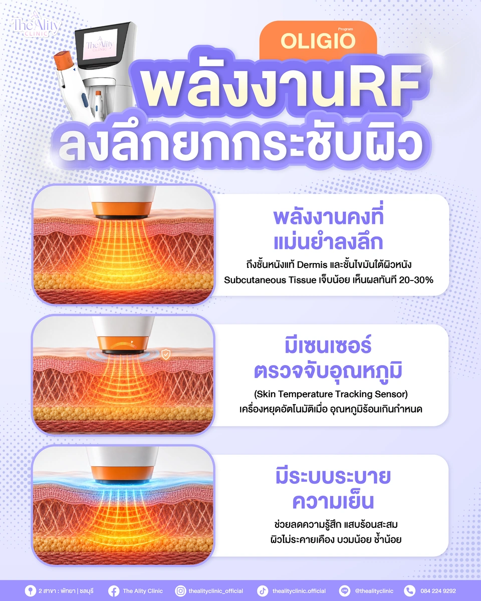 ภาพประกอบเครื่อง Oligio และระบบตรวจจับอุณหภูมิและระบบระบายความเย็น