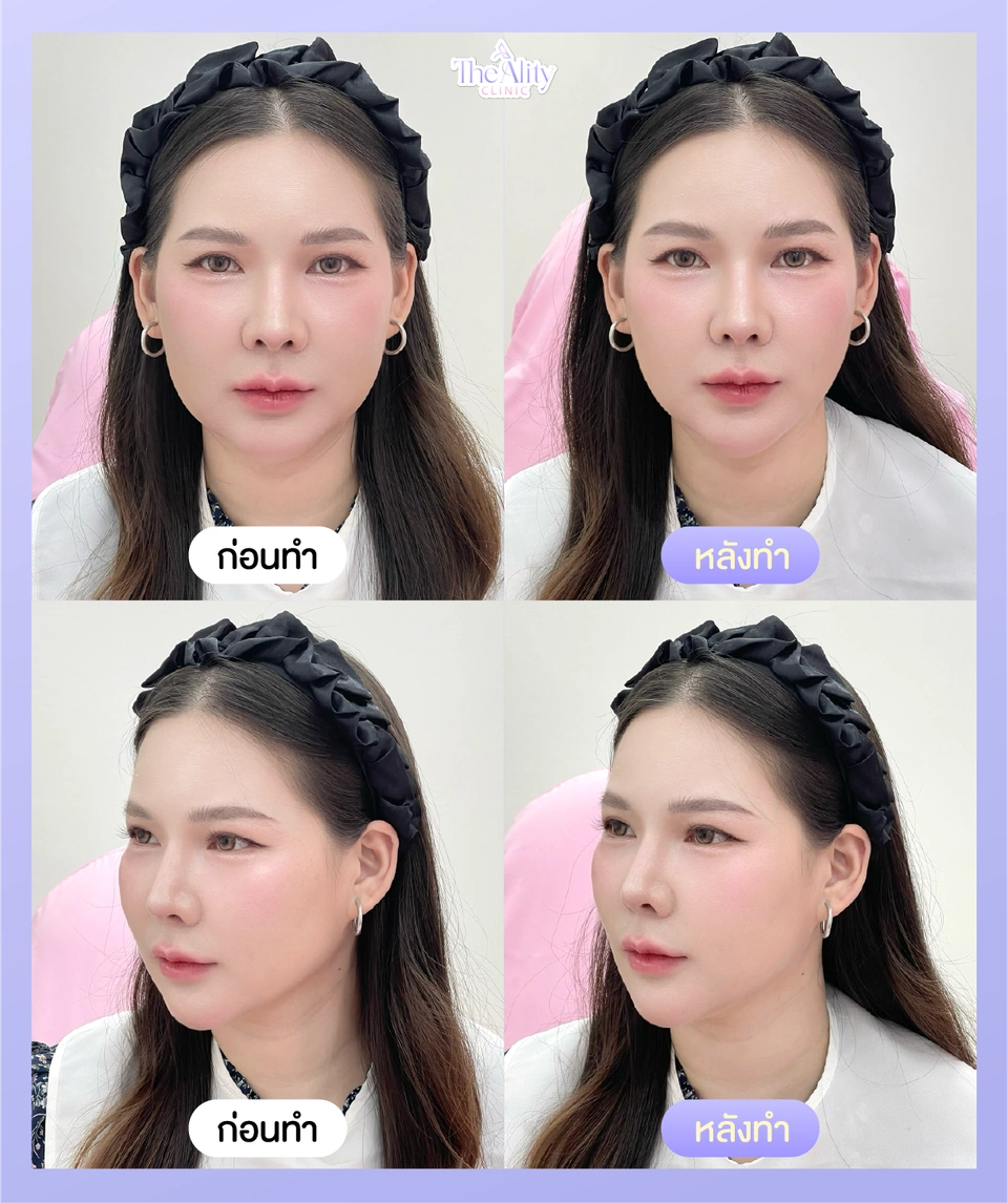 ภาพตัวอย่างรีวิวโปรแกรม Oligio