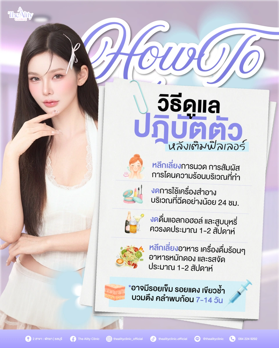 อินโฟกราฟิกวิธีดูแลปากหลังเติมฟิลเลอร์ของ The Ality Clinic